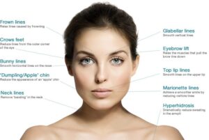 Types of Wrinkles & Wrinkle Treatments - Mymedia Tag